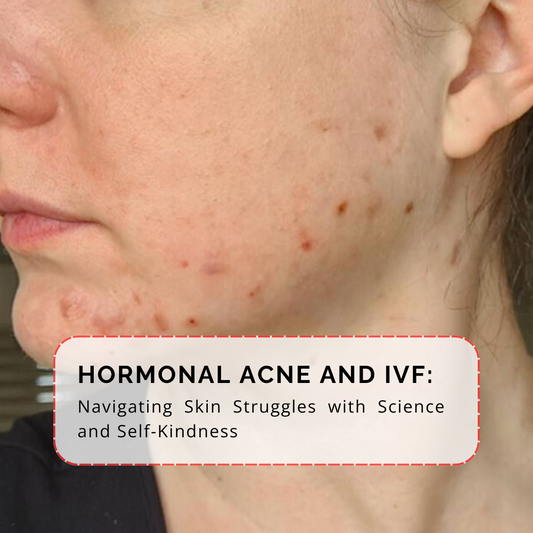 Ivf acne hormonal 