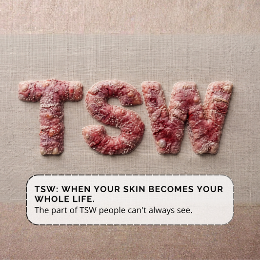 TSW: When Your Skin Becomes Your Whole Life